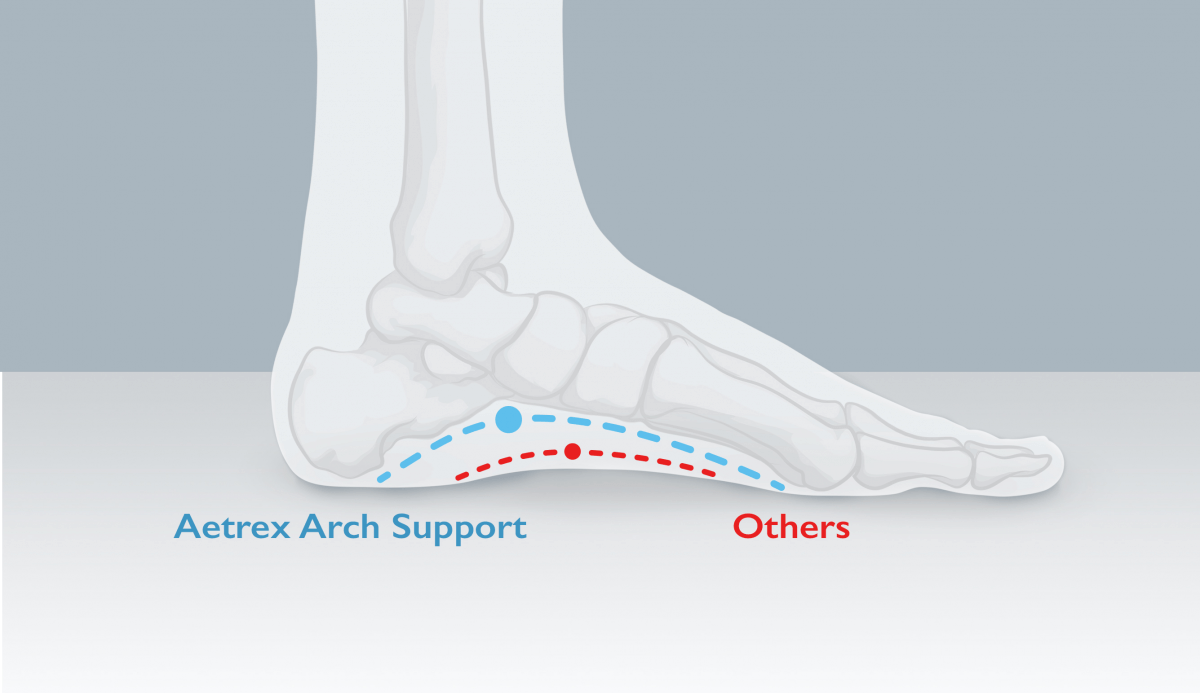 arch support